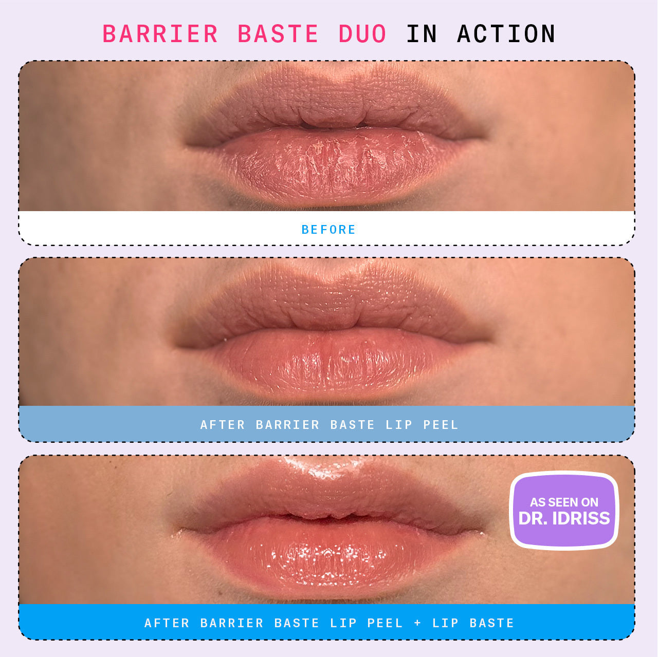 Barrier Baste Lip Peel
