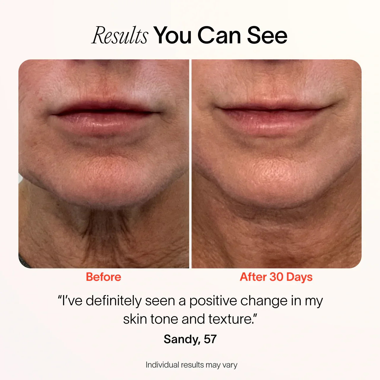 4-in-1 Skincare Wand