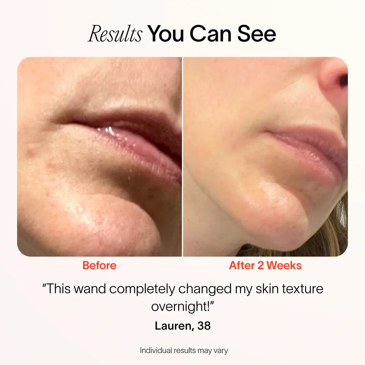 4-in-1 Skincare Wand