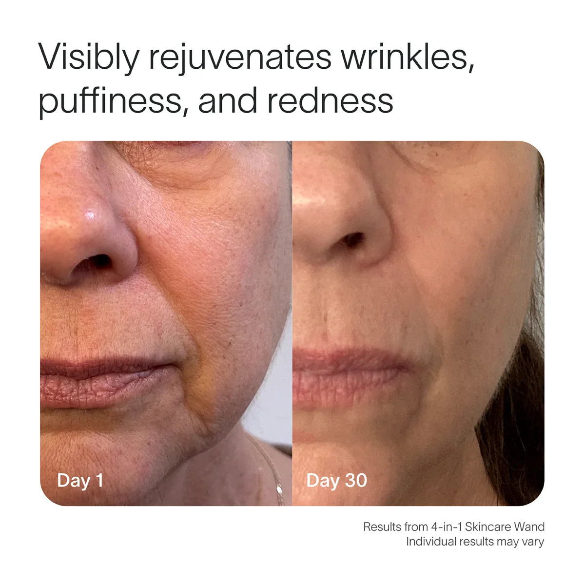 4-in-1 Red Light Therapy Wand & Activating Serum Kit